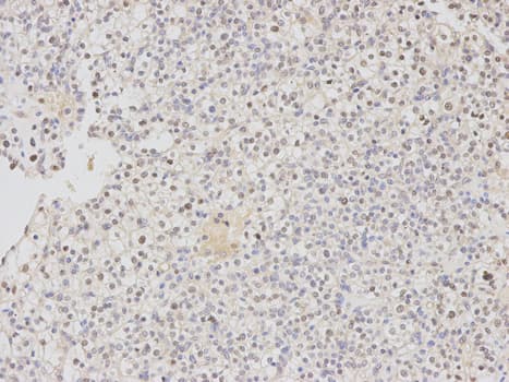 Polyclonal Rabbit anti-Human DDB2 Antibody (IHC, IF, WB)