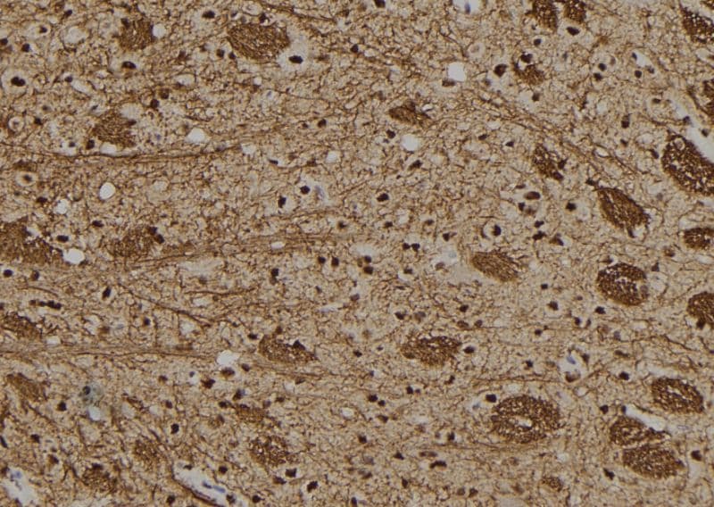 GON4L Antibody