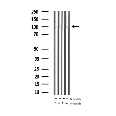 STAT6 Antibody (phospho-Thr645)
