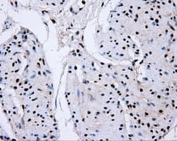SORD / Sorbitol Dehydrogenase Antibody (clone OTI15H2)