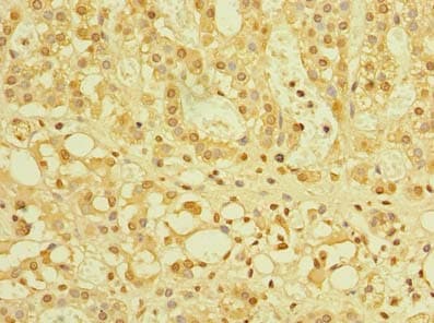 ZBTB32 / TZFP Antibody (aa1-294)