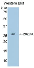 COL1A1 / Collagen I Alpha 1 Antibody (aa1218-1440)