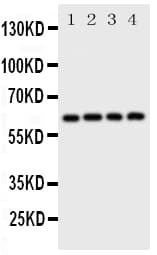 SQSTM1 Antibody (aa91-110)