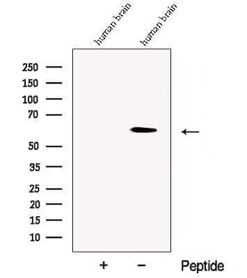 Polyclonal Rabbit anti-Human Yo / CDR2 Antibody (WB)