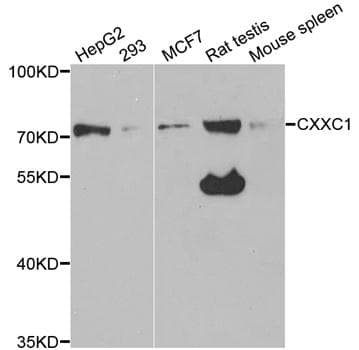 IHC-plus™ Polyclonal Rabbit anti-Human CXXC1 / CGBP Antibody (IHC, IF, WB)