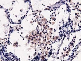 OSBPL11 Antibody (clone OTI5A10)