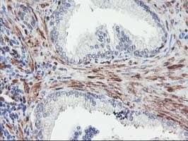 MEF2C Antibody (clone OTI1B6)