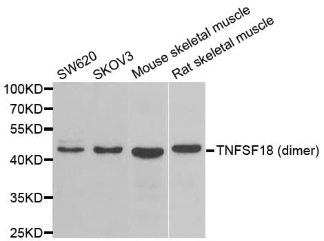 Polyclonal Rabbit anti-Human TNFSF18 / GITRL Antibody (IHC, WB)