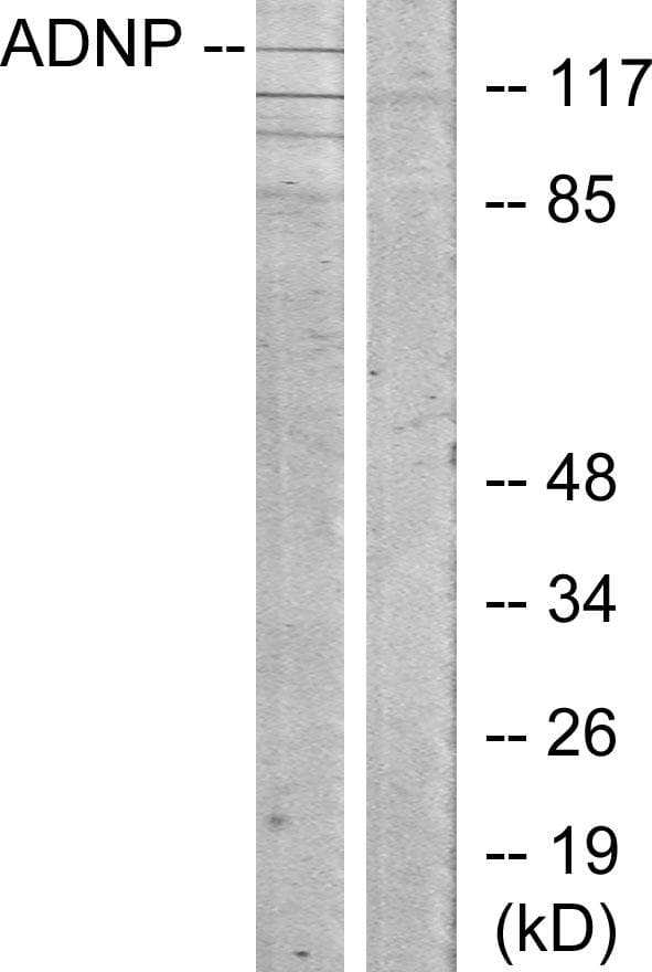 ADNP Antibody
