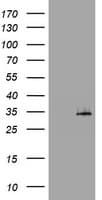 ABCB1 / MDR1 / P Glycoprotein Antibody (aa995-1280, clone OTI1A3)