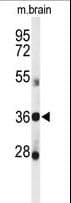 DDO / D-Aspartate Oxidase Antibody (aa102-130)