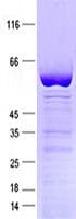 Human VDAC2 Protein (Recombinant GST, N-terminus + His, C-terminus)