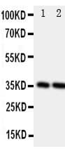 Polyclonal Rabbit anti-Rat PDPN / Podoplanin Antibody (aa155-166, WB)