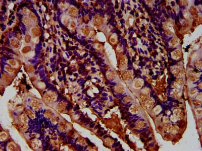 ADGRG1 / GPR56 Antibody