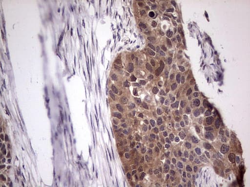 BFSP2 Antibody (aa184-415, clone OTI4E7, Carrier-free)