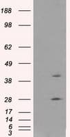 GLUL / Glutamine Synthetase Antibody (clone OTI1F4)