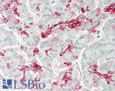 IHC-plus™ GALNT9 Antibody (aa296-322)