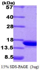 Human CDK2AP1 / DOC1 Protein (Recombinant His)
