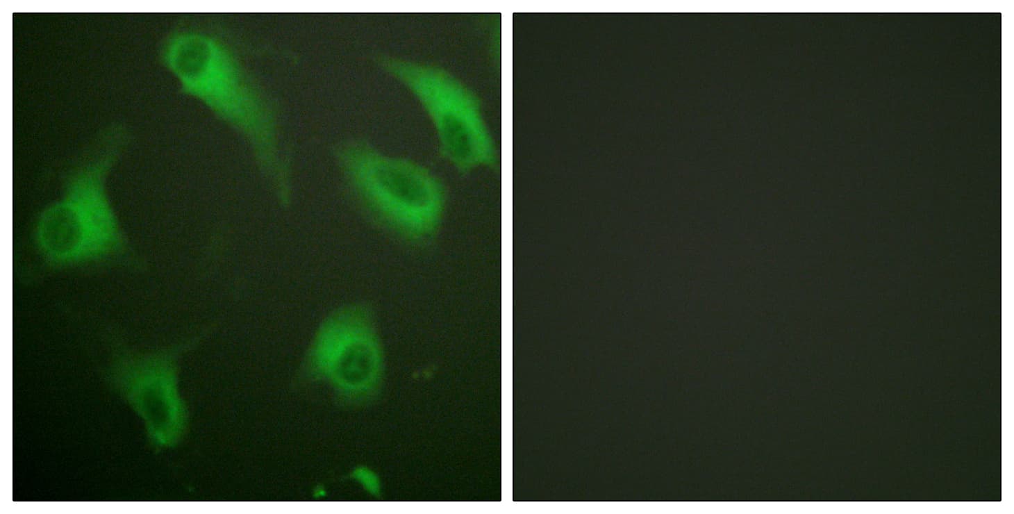 Polyclonal Rabbit anti-Human C5AR1 / CD88 / C5a Receptor Antibody (aa301-350, IHC, IF, WB)