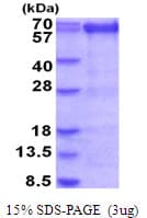 Human PRMT3 Protein (Recombinant His)