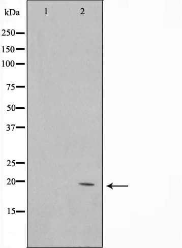 Polyclonal Rabbit anti-Human NTPCR / C1orf57 Antibody (IF, WB)