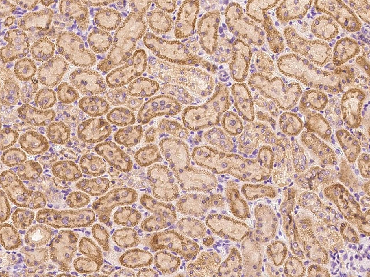 Polyclonal Rabbit anti-Mouse MIA40 / CHCHD4 Antibody (Preservative Free, IHC)
