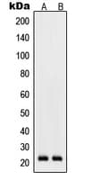 RHOD Antibody (Internal)