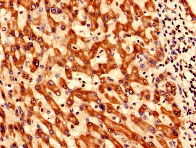 Polyclonal Rabbit anti-Human SYNJ2BP / OMP25 Antibody (IHC, WB)