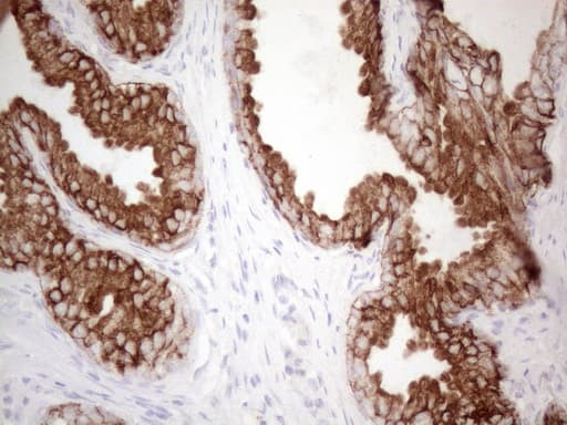 KRT16 / CK16 / Cytokeratin 16 Antibody (clone OTI2H8)