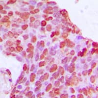BCOR Antibody (Internal)