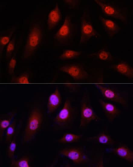YAP / YAP1 Antibody (AP)