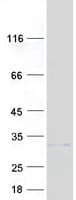 Human TMEM189 Protein (Recombinant Myc-DDK (Flag))