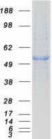 Human PPM1F Protein (Recombinant Myc-DDK (Flag))