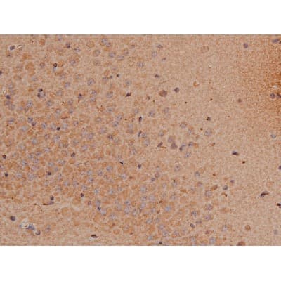 Polyclonal Rabbit anti-Human SP1 Antibody (phospho-Thr739, IHC, IF, WB)