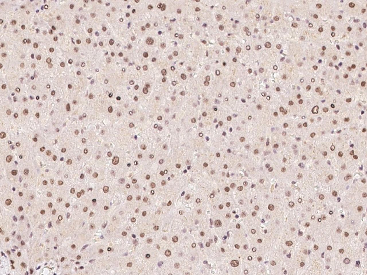ZFP64 Antibody