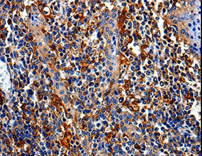 Polyclonal Rabbit anti-Human COX16 / C14orf112 Antibody (IHC)