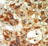MAPK12 / ERK6 / SAPK3 Antibody (aa339-367)