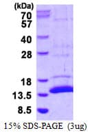 Mouse S100A7A / S100A15 Protein (Recombinant His)