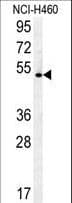 DENND1B Antibody (aa39-68)