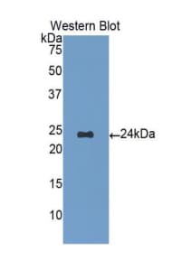 ORM1 / Orosomucoid Antibody (aa19-201)