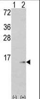 S100A6 / Calcyclin Antibody (aa37-67)