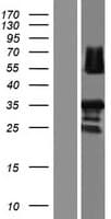 RAD52 Protein (Over-Expression Lysate Myc-DDK (Flag))