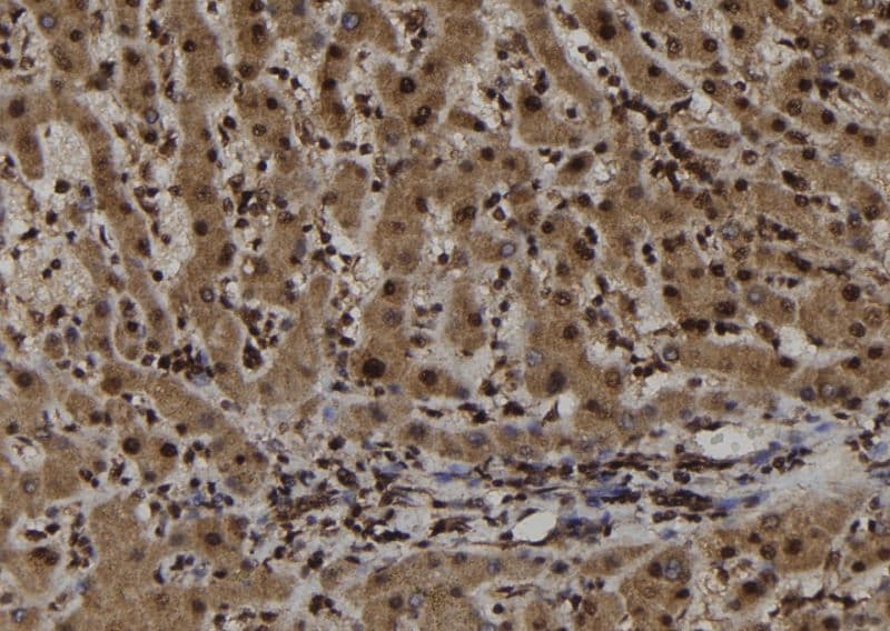 TRIM44 Antibody