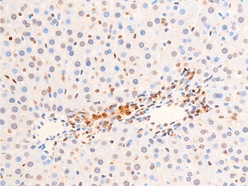 Polyclonal Rabbit anti-Human CHEK2 / CHK2 Antibody (phospho-Thr383, IHC, IF, WB)