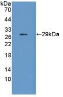 CHRNE Antibody (PE)