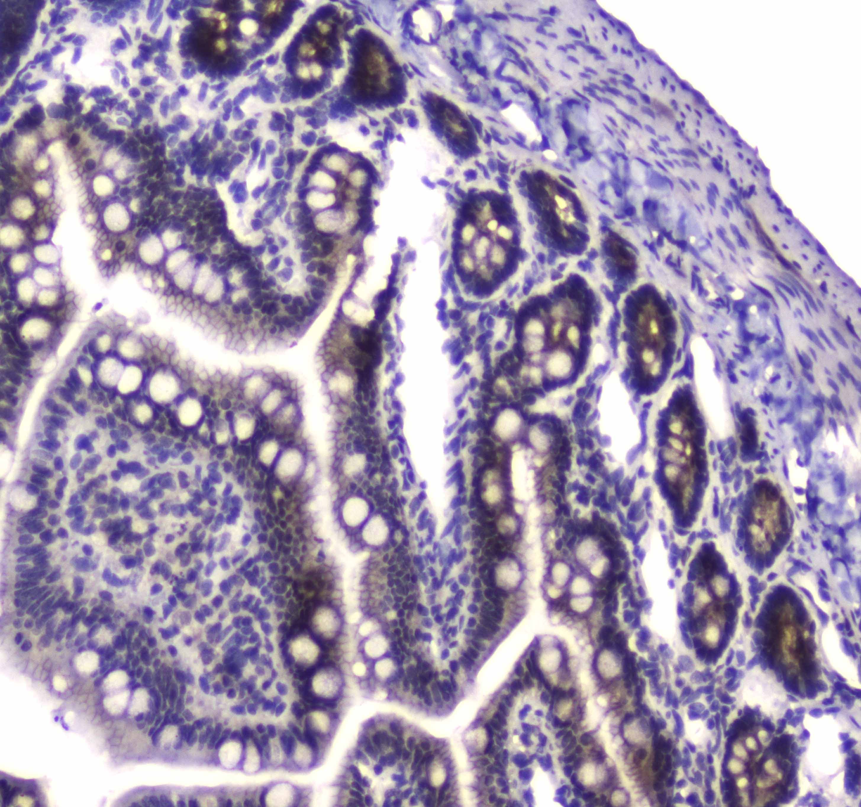 PARN Antibody