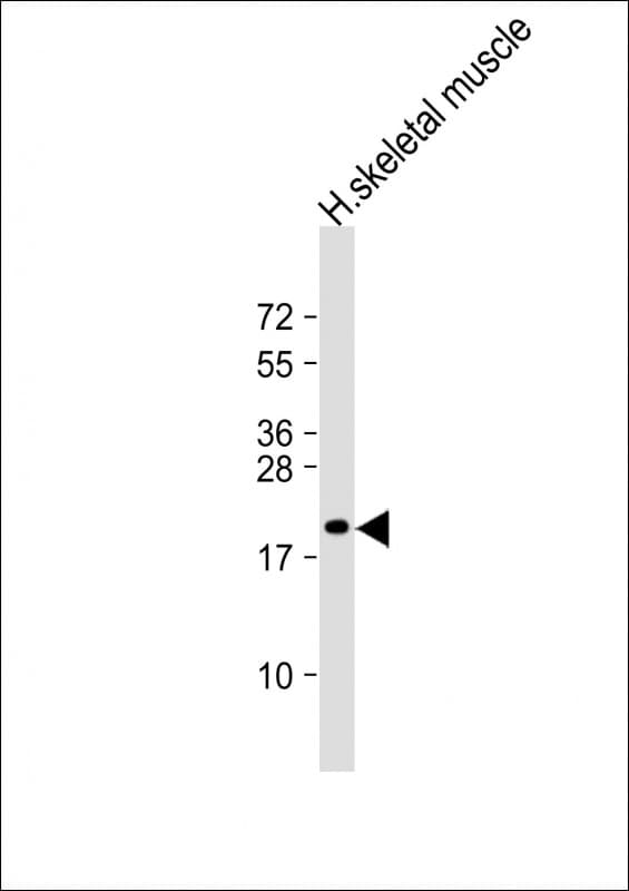 Polyclonal Rabbit anti-Human NACA Antibody (aa36-69, WB)