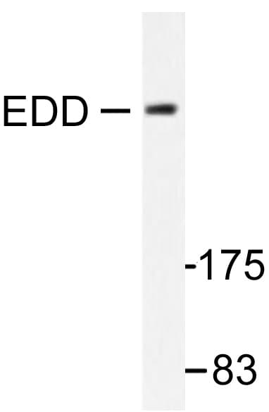 UBR5 Antibody (Thr14)