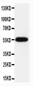 Polyclonal Rabbit anti-Human CASP8 / Caspase 8 Antibody (aa458-473, IHC, WB)