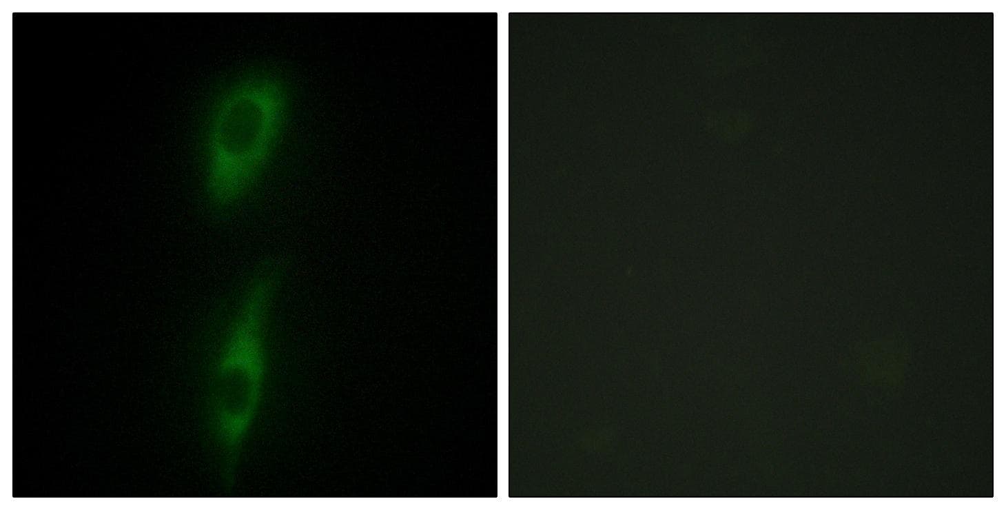 ACVRL1 Antibody